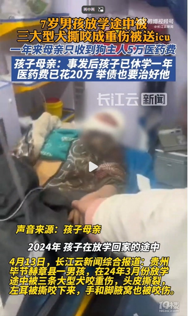 7岁男孩上学途中被三大型犬撕咬面目全非