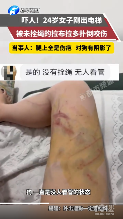 女子遭大型犬撕咬10分钟主人未现身