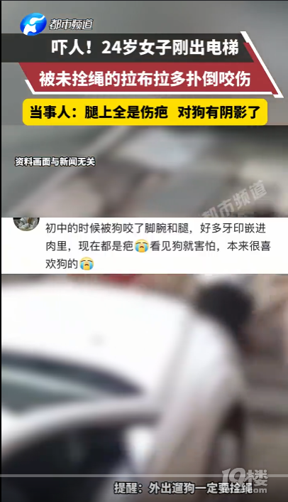 女子遭大型犬撕咬10分钟主人未现身