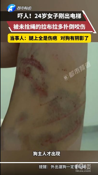 女子遭大型犬撕咬10分钟主人未现身