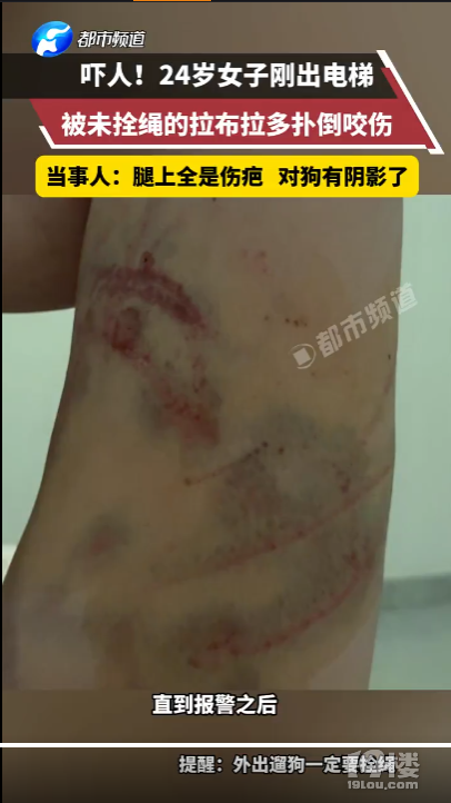 女子遭大型犬撕咬10分钟主人未现身