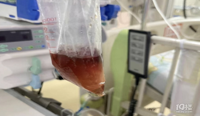 吃了一包零食,5歲娃進了ICU!這病南方高發(fā),很多人不知道