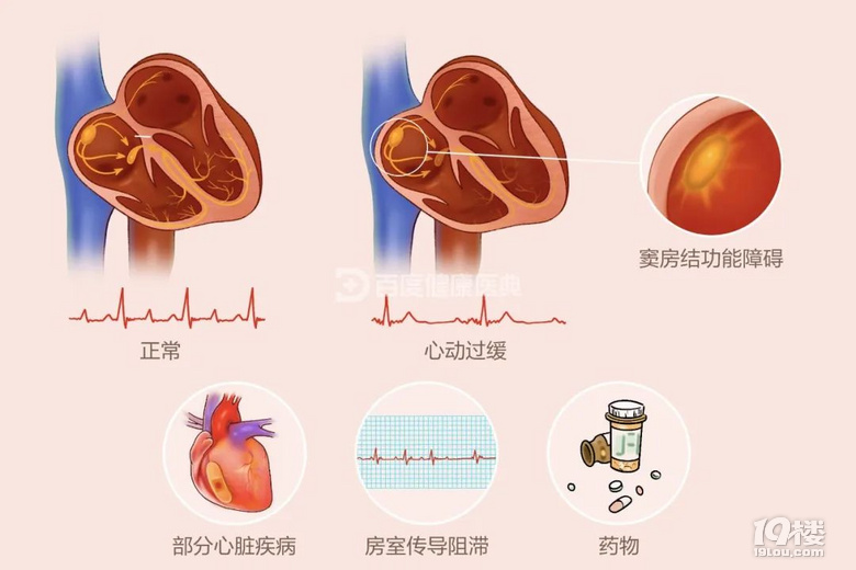 他們是“心臟電工”,精準(zhǔn)修復(fù)心臟老化的 "電路故障"