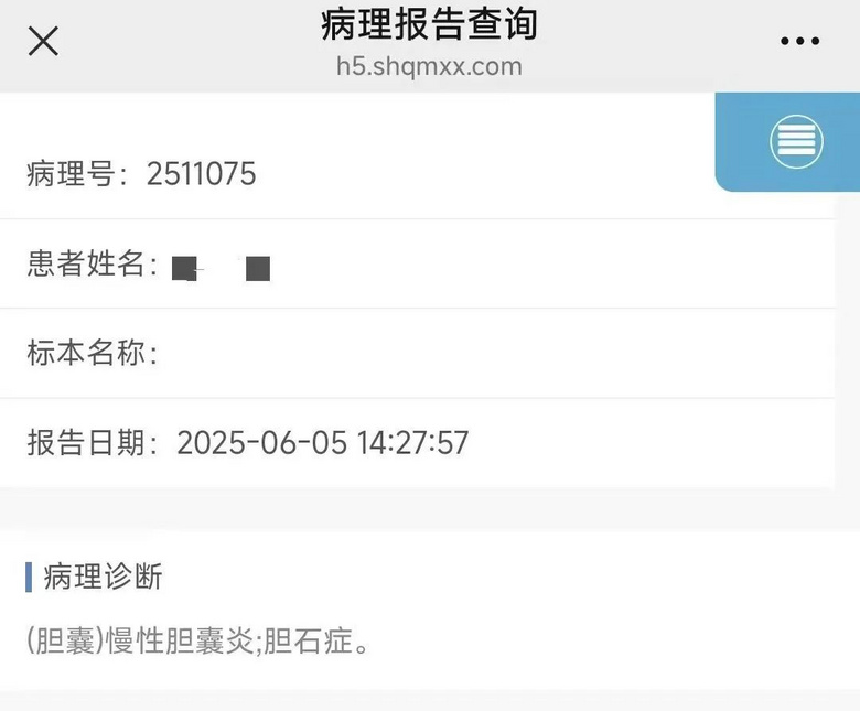 奶奶、大姑、小姑、媽媽、姨媽還有我都切了膽囊