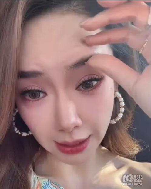 上節(jié)目眼睛變形引爭議!知名女星大方承認過度醫(yī)美:打肉毒打僵了