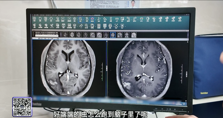 ӝMRِˣrF(xin)ßƬc@LԇP(gun)