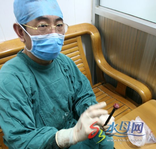 4岁少年菊花被暴不治身亡!你办公室是什么椅子