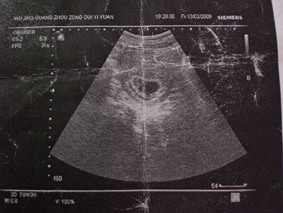 20周B超猜男女-准妈妈论坛-杭州19楼