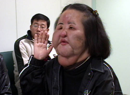 同学们 能不整容的千万别整哦