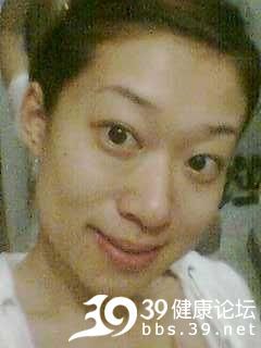 【转】超强啊,某女晒削骨手术全过程~不看后悔