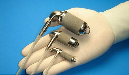 全球首例未成年人植入永久性人造心脏手术成功