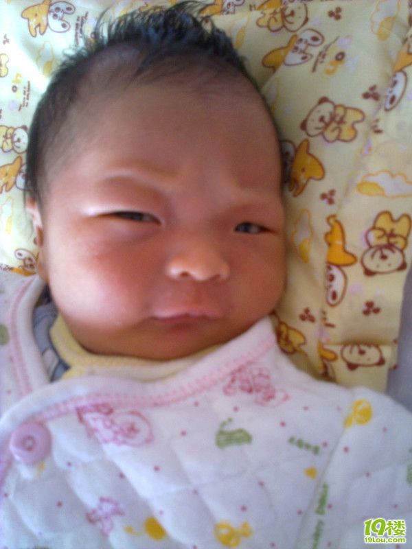 毛毛儿子的怀孕症状和我的剖腹产经历-准妈妈