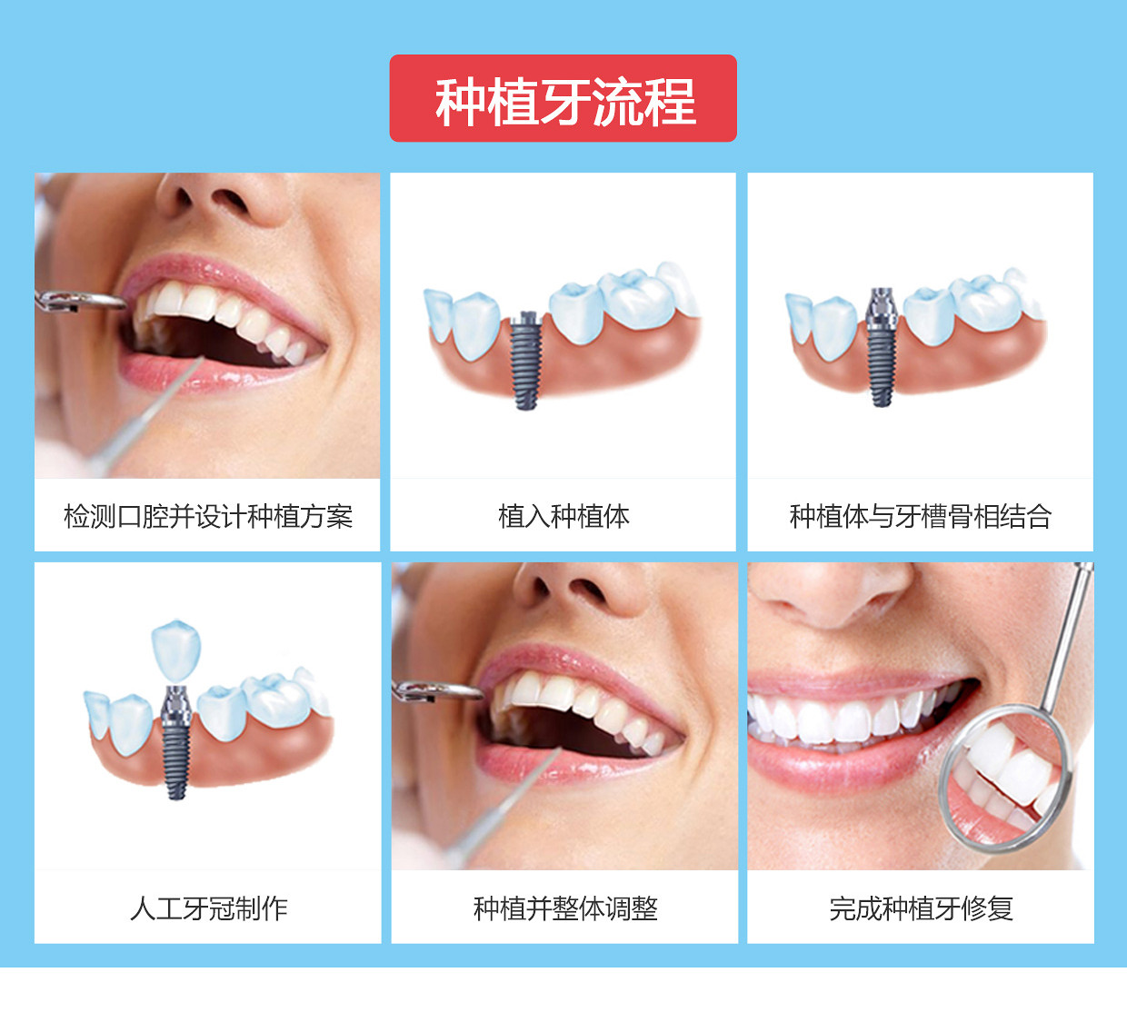 时光整形种植牙年中钜惠-19楼优惠券
