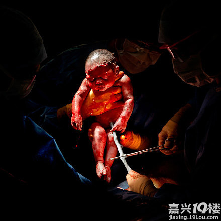 实拍婴儿刚出生的样子口味略重慎点