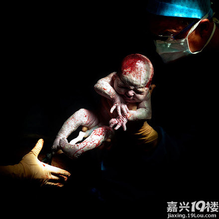 实拍婴儿刚出生的样子口味略重慎点