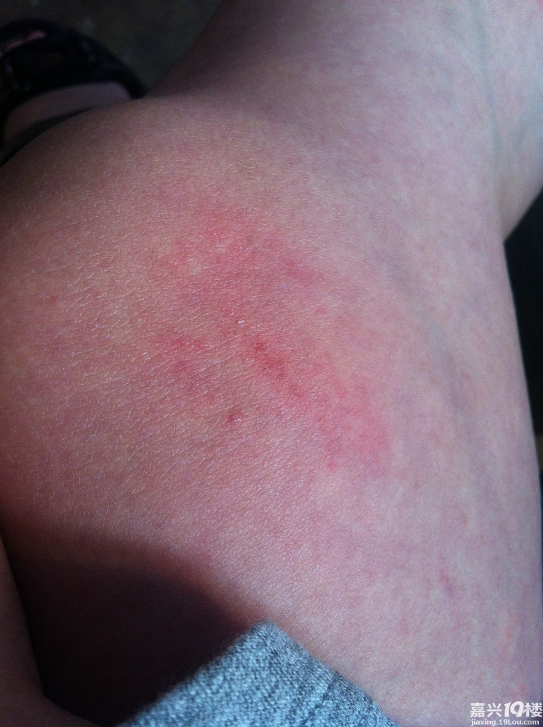 买的衣服穿着过敏商家只换不退有这道理么