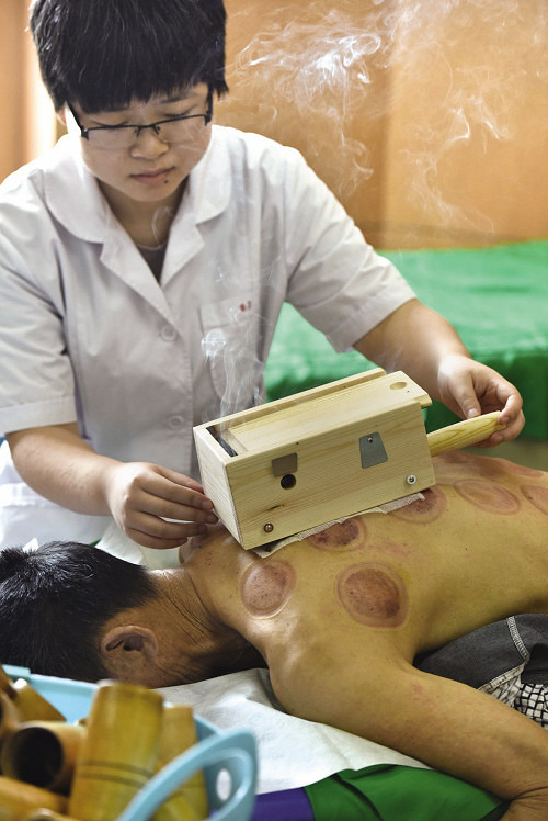雷火灸冬病夏治显奇效