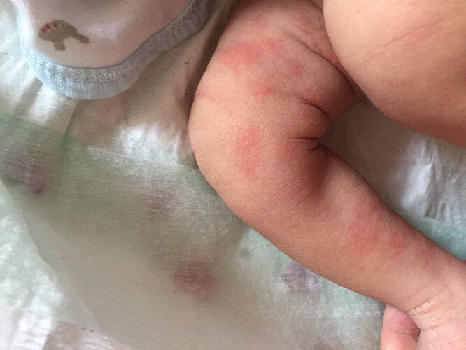 �Ҽ�������ô�ˣ�