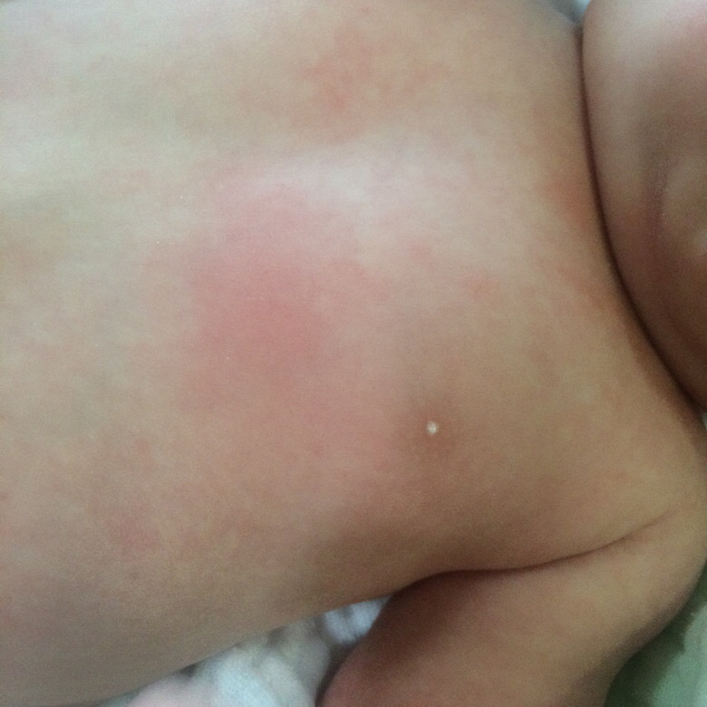 ��ҽ��������54�촿ĸ��ι����2���鷿��