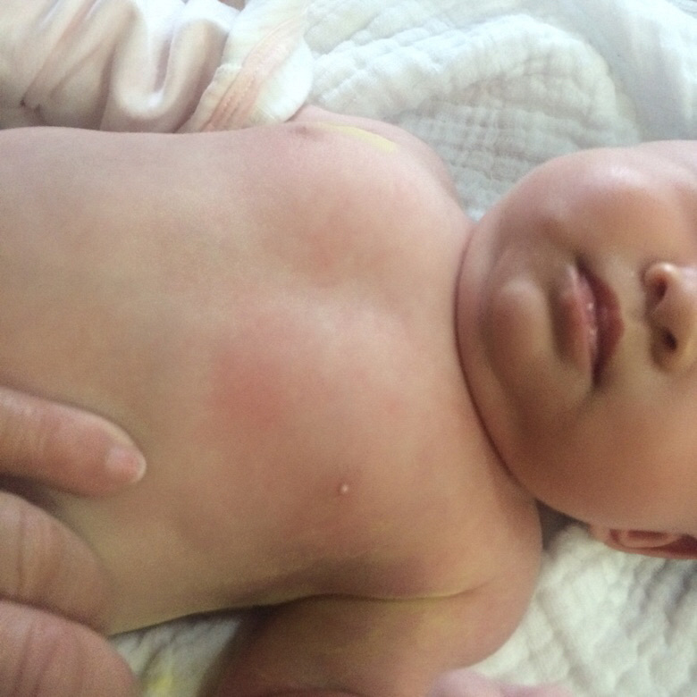 ��ҽ��������54�촿ĸ��ι����2���鷿��