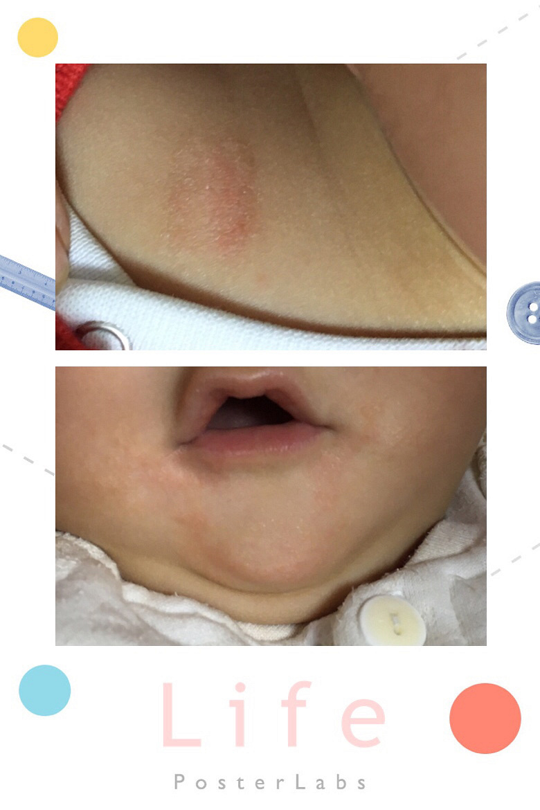 �����߸��£��粿�������������