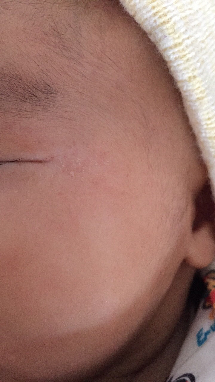 ��ҽ����������Щ������ʪ���ɶ����Ϊ֮