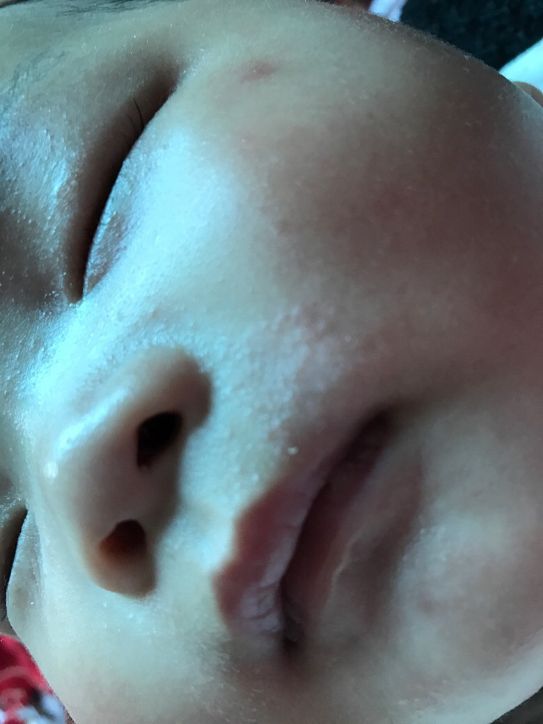 ����ʪ��������ѯ����ҽ�����лл����