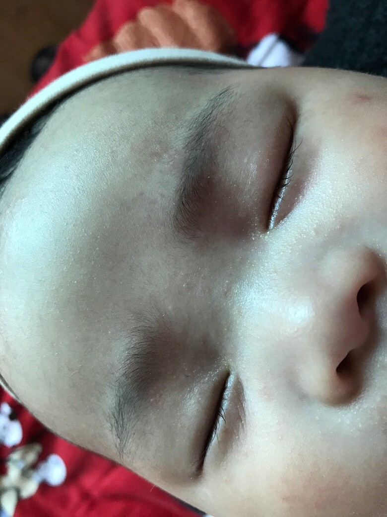 ����ʪ��������ѯ����ҽ�����лл����