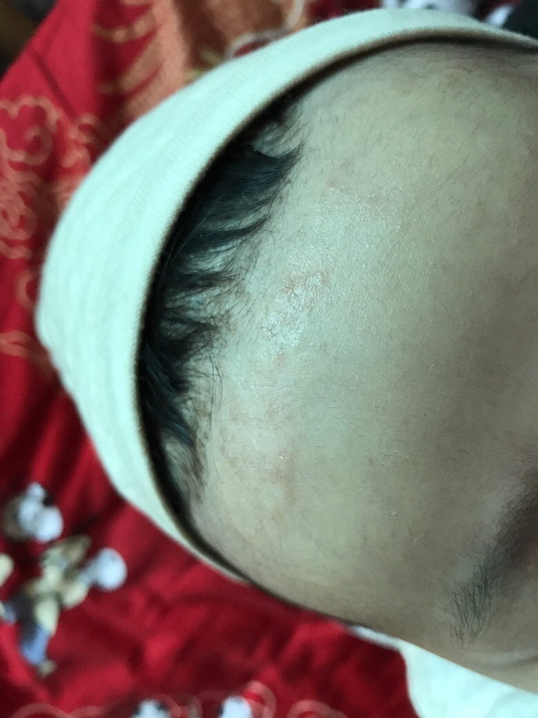 ����ʪ��������ѯ����ҽ�����лл����