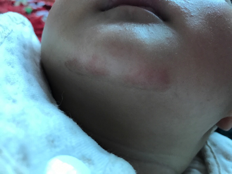 ����ʪ��������ѯ����ҽ�����лл����