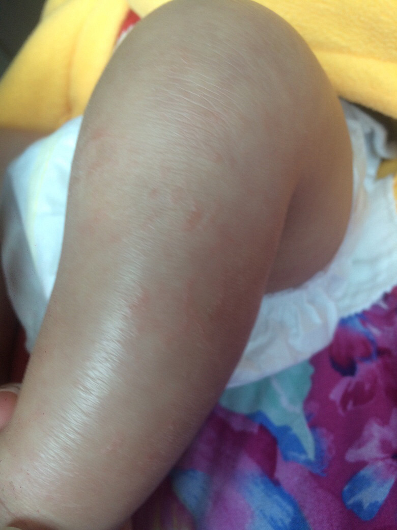 ��ҽ����������������ô��