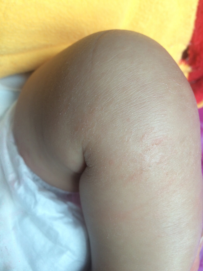 ��ҽ����������������ô��