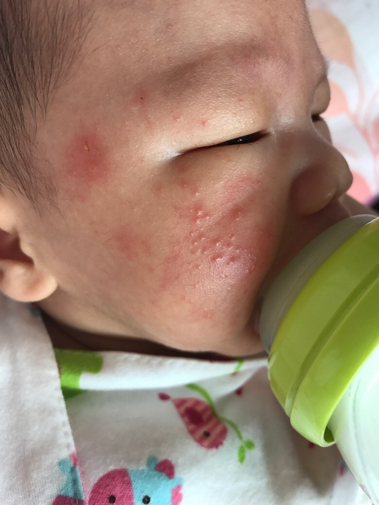 ��ҽ�����æ