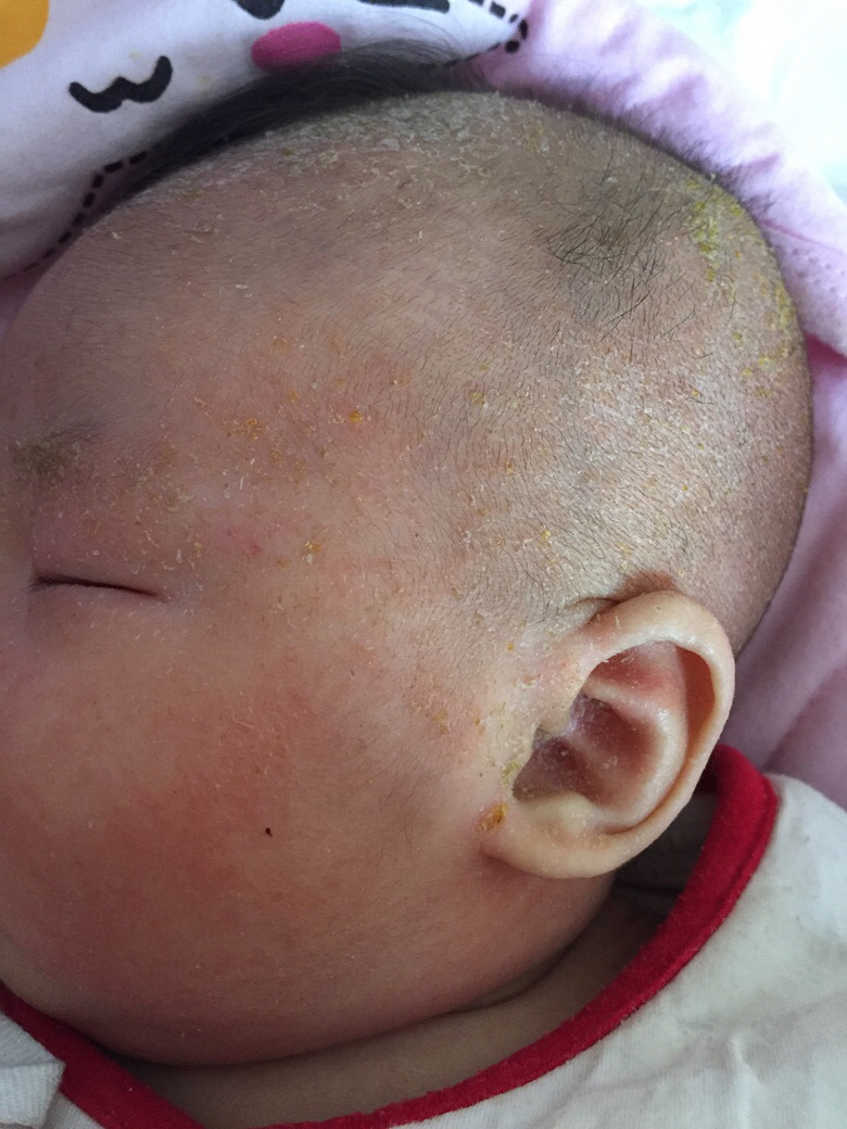 ��Ƥ ���� ���� ����ʪ������