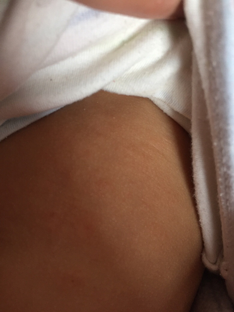 ��Ƥ ���� ���� ����ʪ������