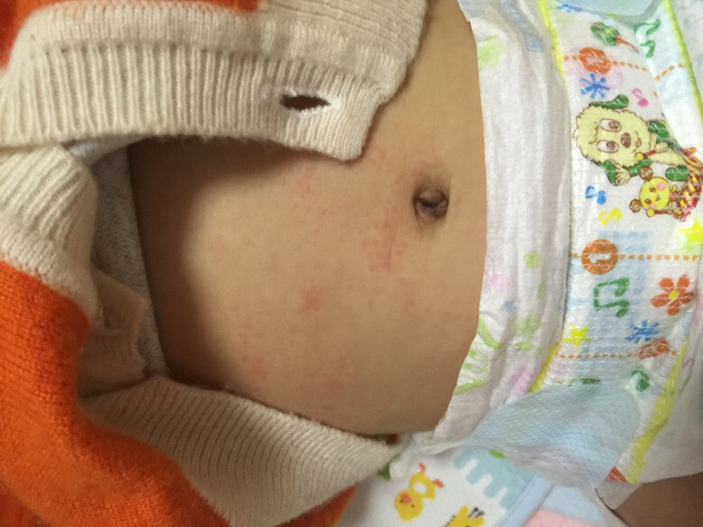 ҽ�����߸��±��������������������ϳ������ӣ��鷳���¡�