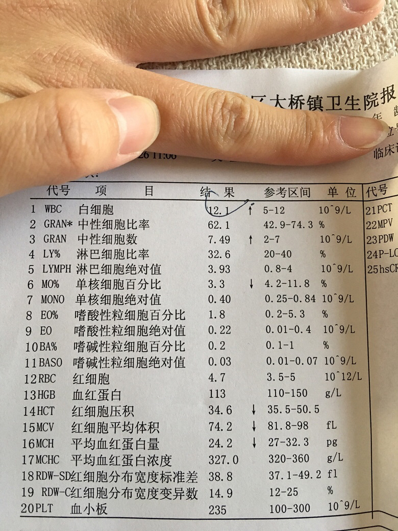 С���ӾŸ��£����¶�ʮ���ŵ�ʱ��ͻȻ��