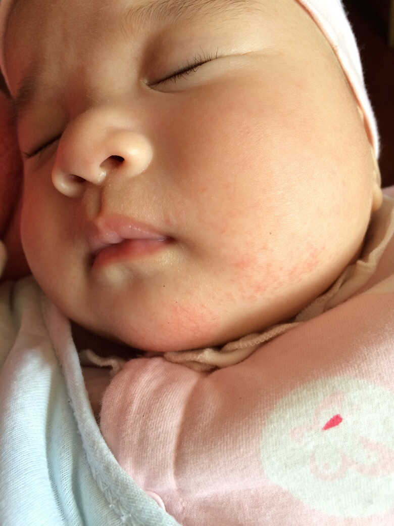 ��ҽ������æ����