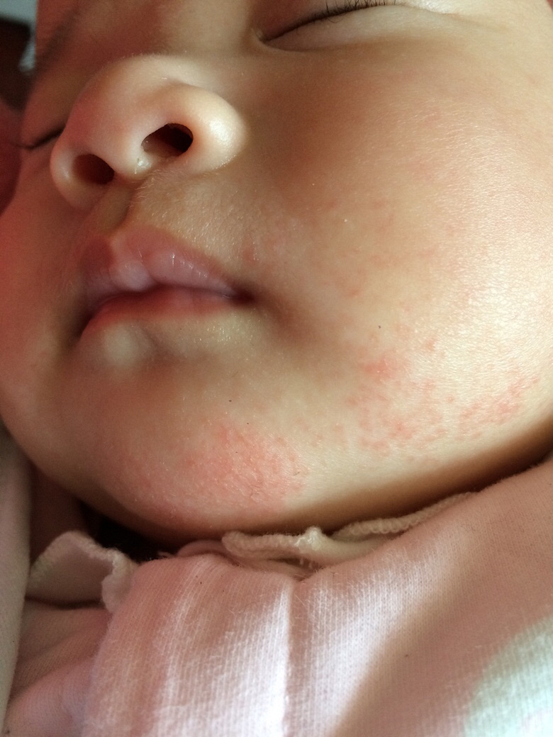 ��ҽ������æ����