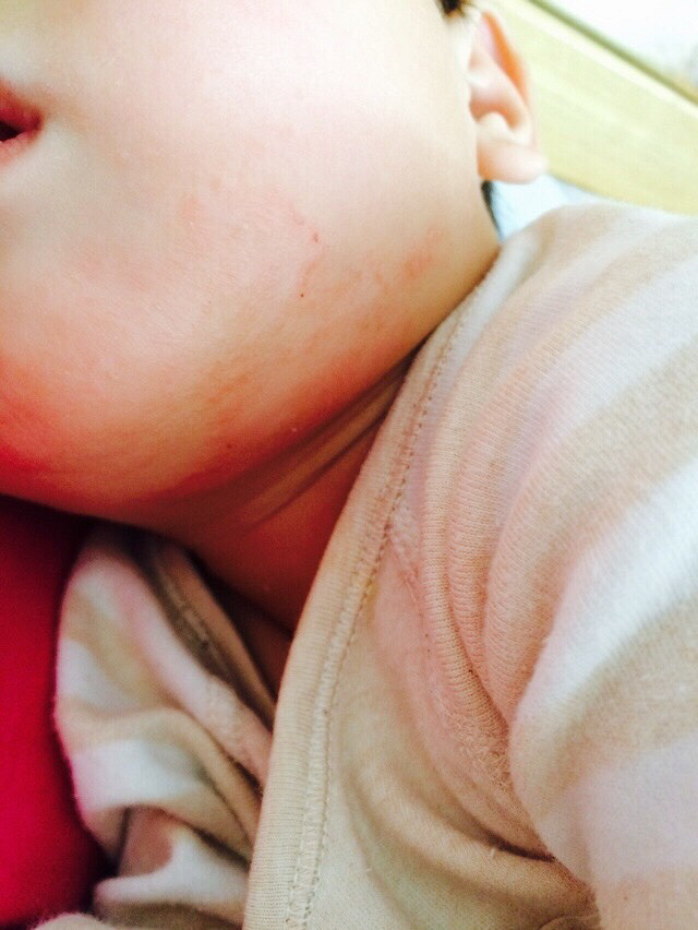 �����°ͺ���е���Ƥ ��ô�죿