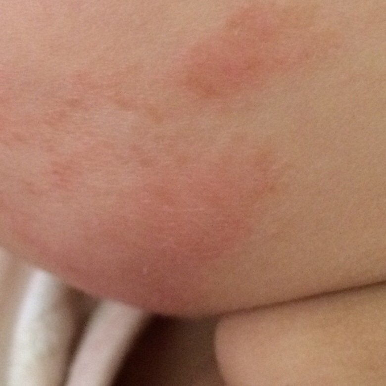 �����°ͺ���е���Ƥ ��ô�죿