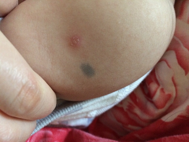 �������±����ֱ�����ߣ���֪����ʲô