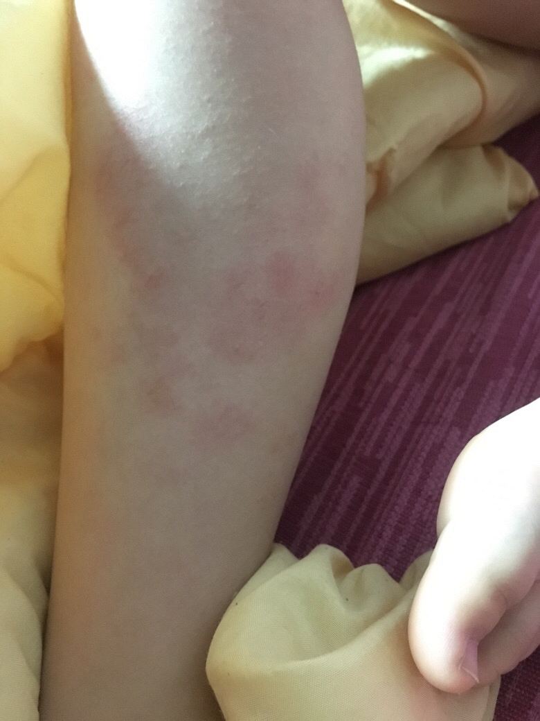 �Ҽұ���8���ˣ�������Щ��֪����ʪ��ǹ�������1����������