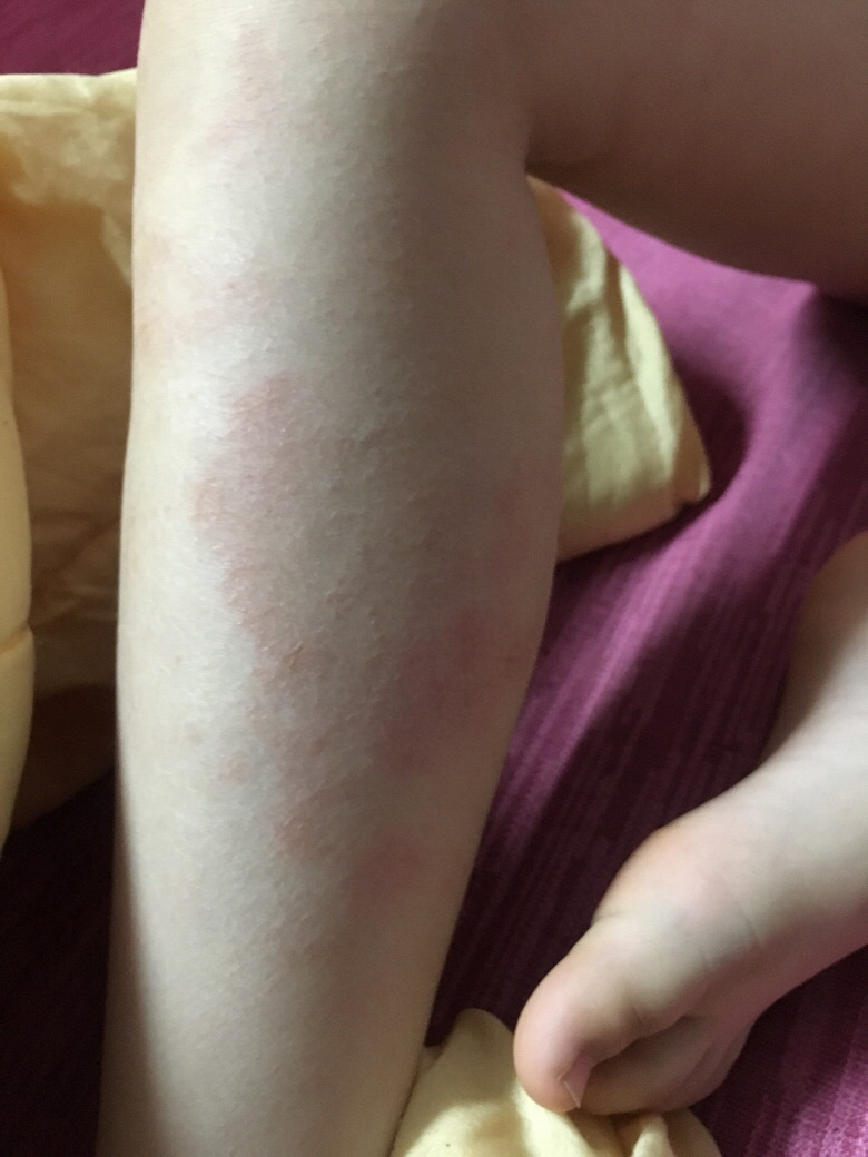 �Ҽұ���8���ˣ�������Щ��֪����ʪ��ǹ�������1����������