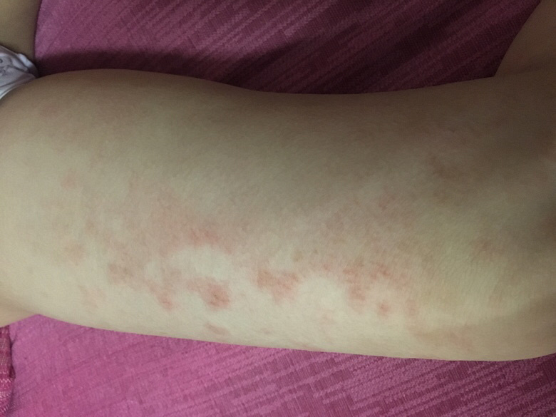 �Ҽұ���8���ˣ�������Щ��֪����ʪ��ǹ�������1����������