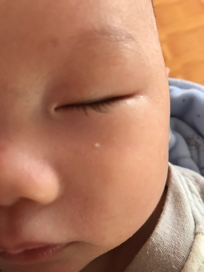 �ǲ���֬����