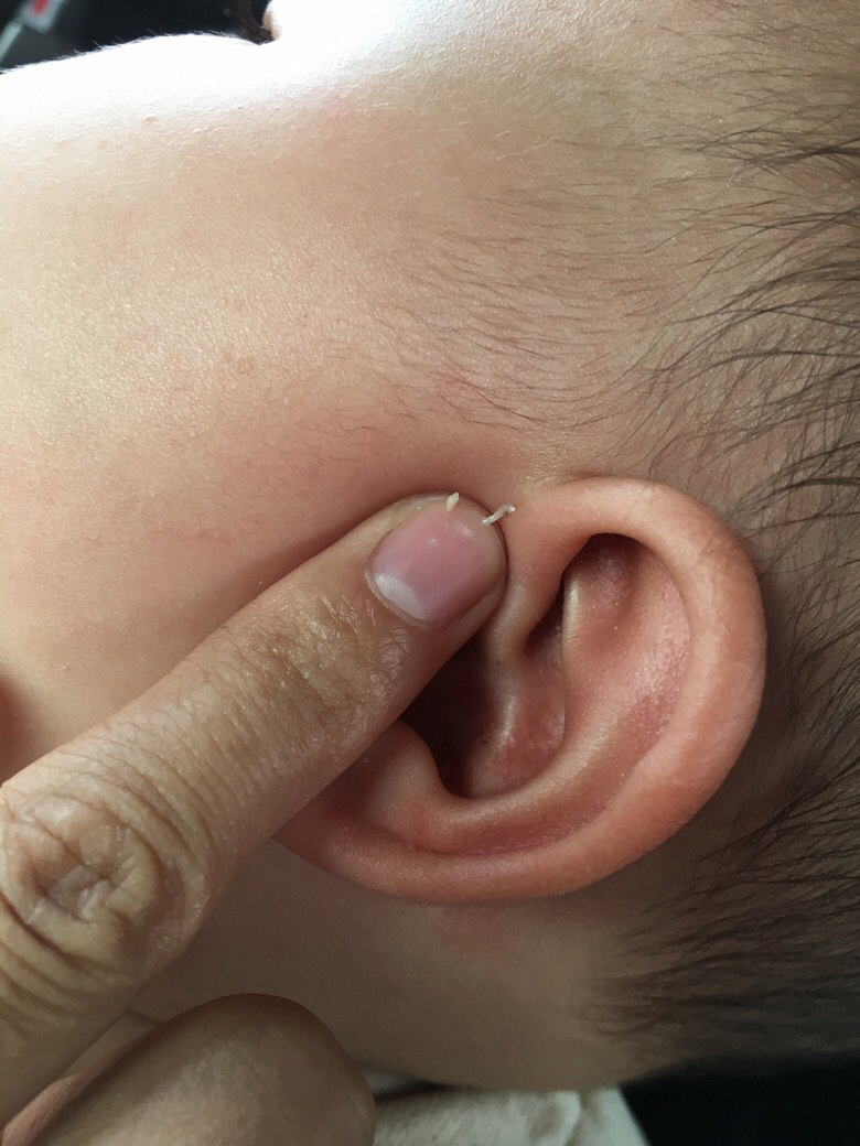 ����ǰ���и�С�ף���һ�³����˰�ɫ������