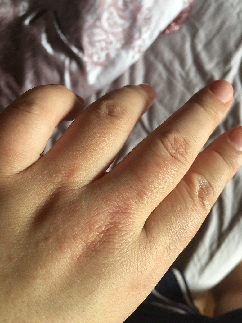 Ƥ������