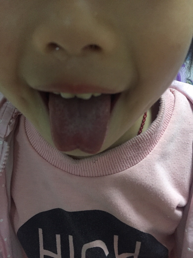 ������ϵ����Ӱ�췢��