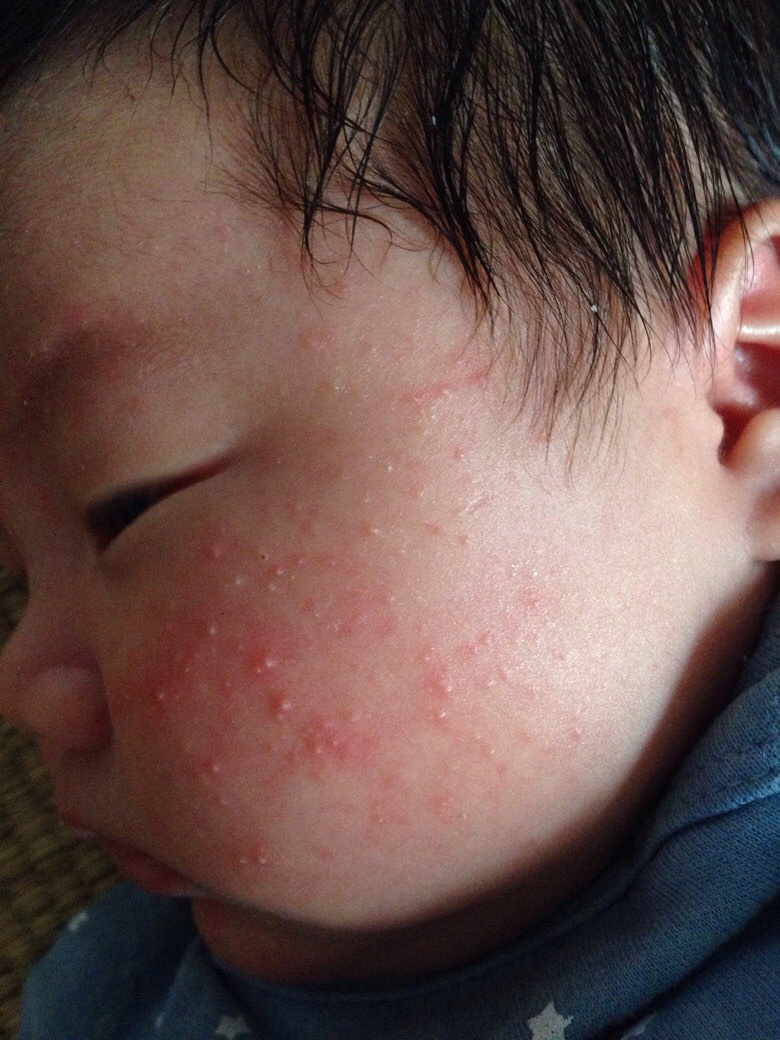 �����±���ʪ��